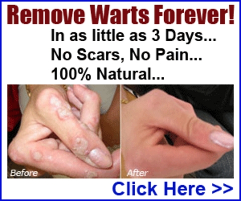 Product picture Getting Rid Of Warts Forever By Ana Robins (PLR)